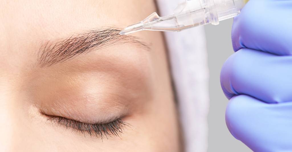 Eyebrow Transplant