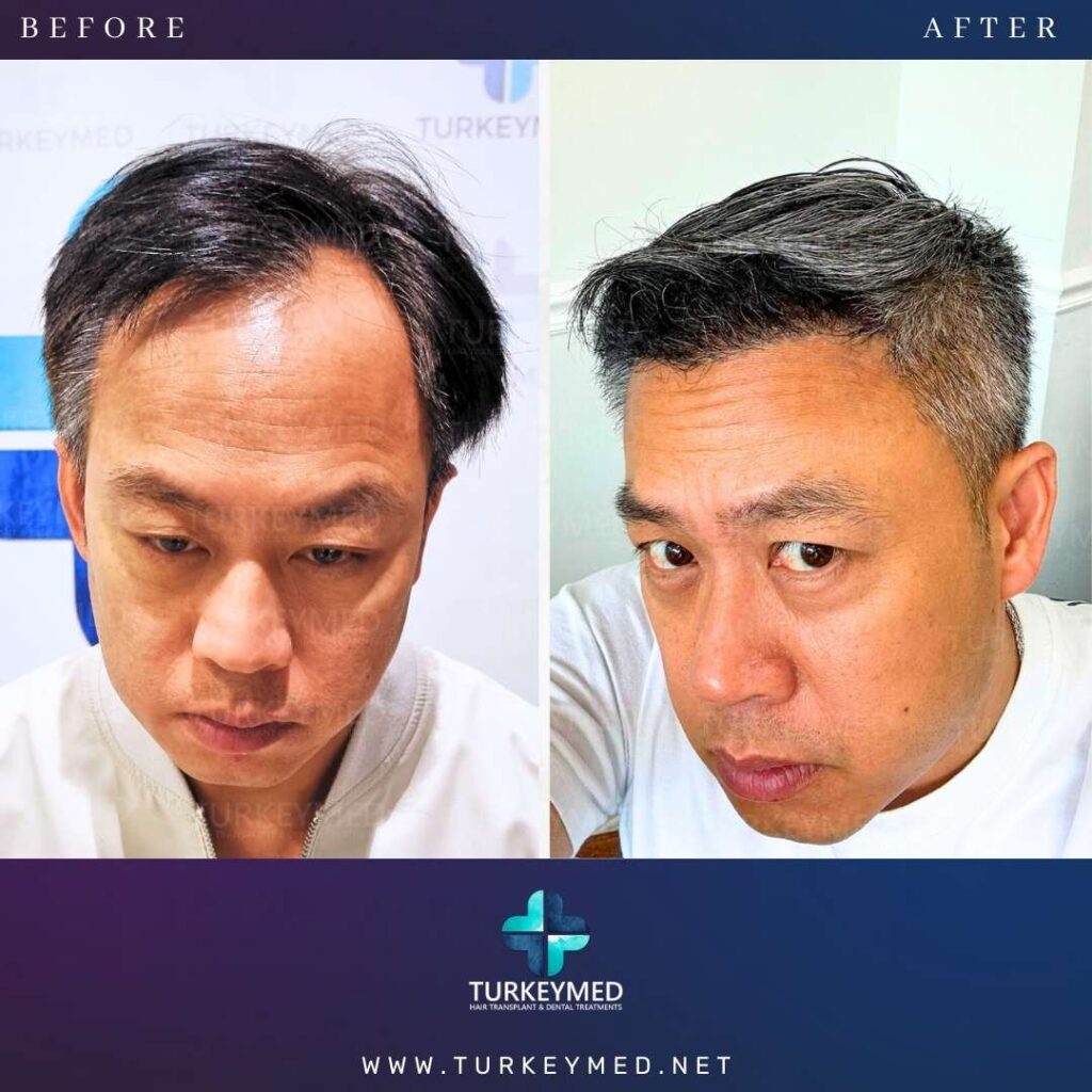 Before & After (3)