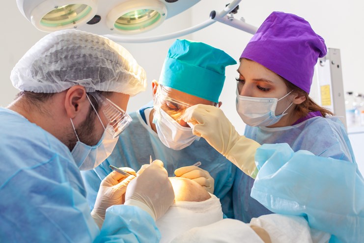hair implant surgery