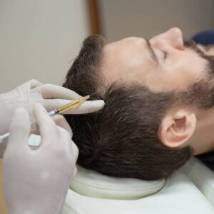 hair grafting