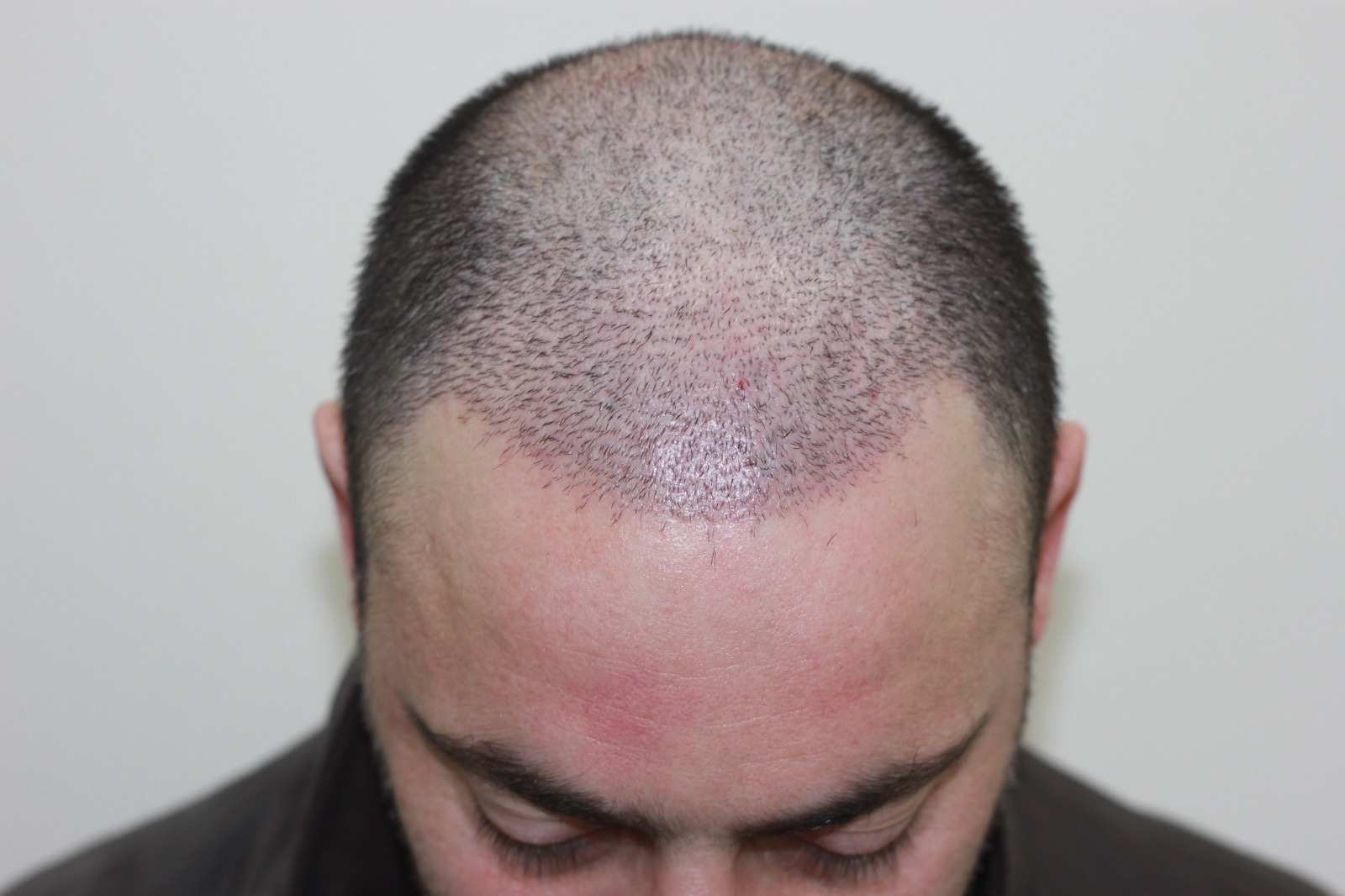 hair transparent