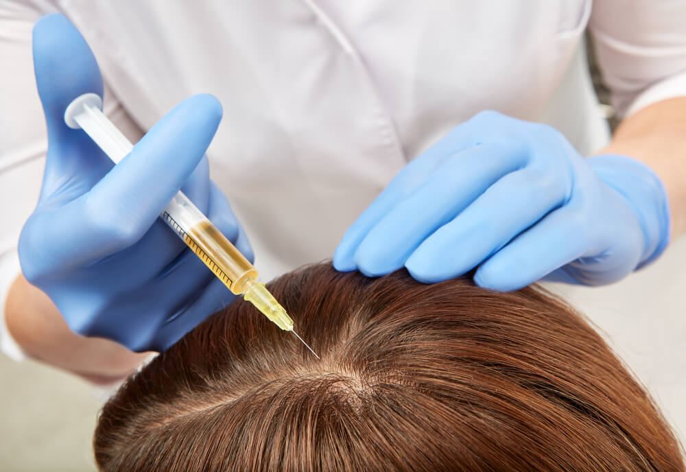 Platelet-Rich Plasma (PRP)