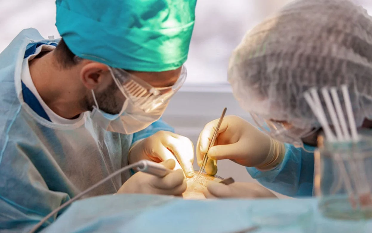 hair surgery price