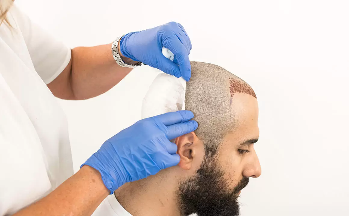 hair surgery turkey