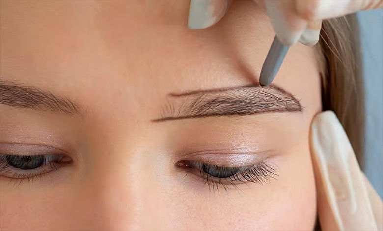 Trasplante de cejas