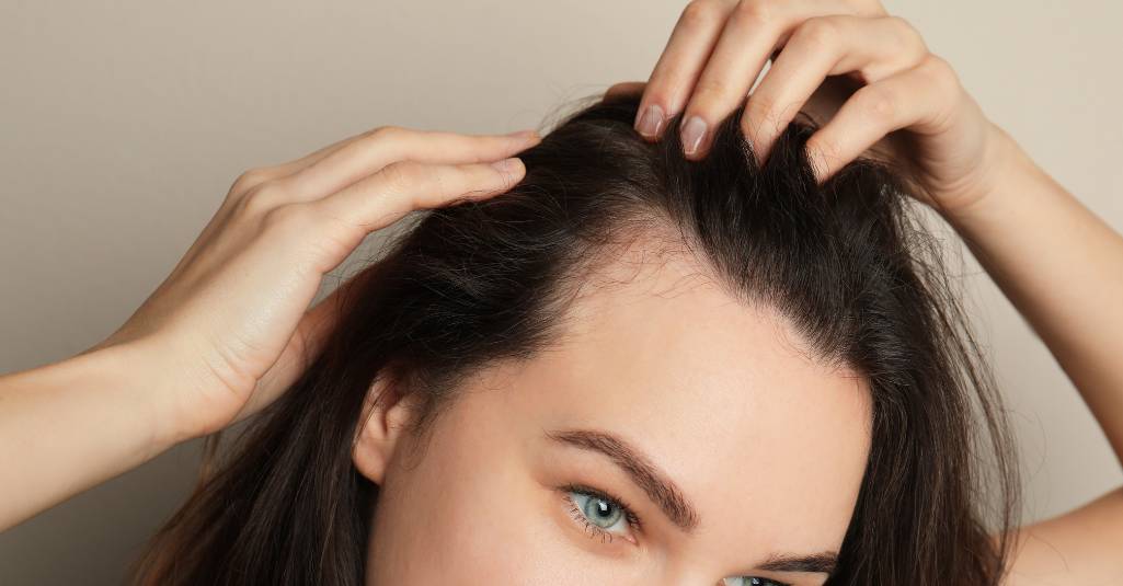 Greffe de Cheveux pour Femmes