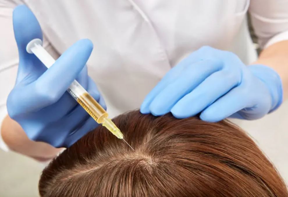 Plasma rico en plaquetas (PRP)