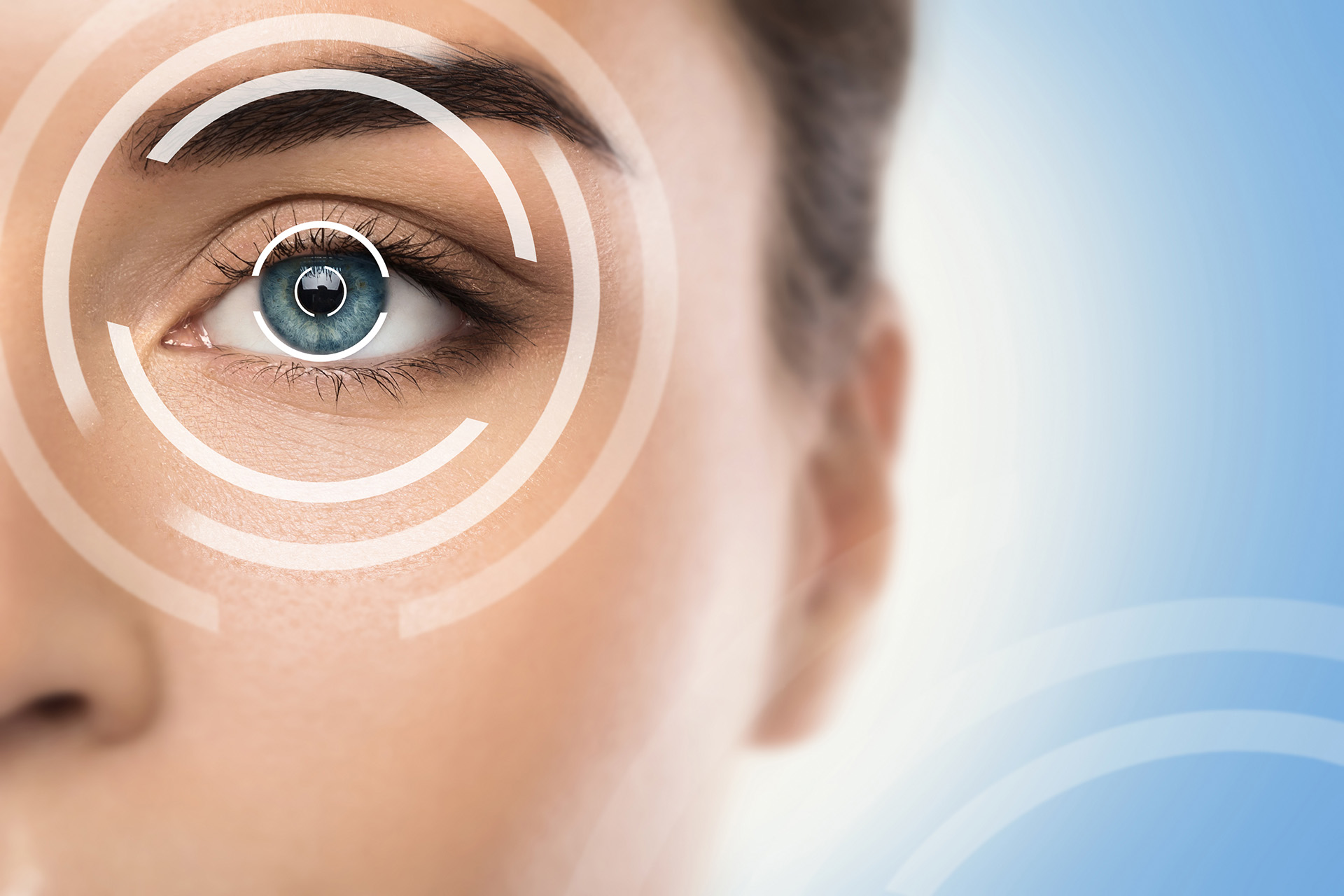 Cirugía LASIK en Turquía